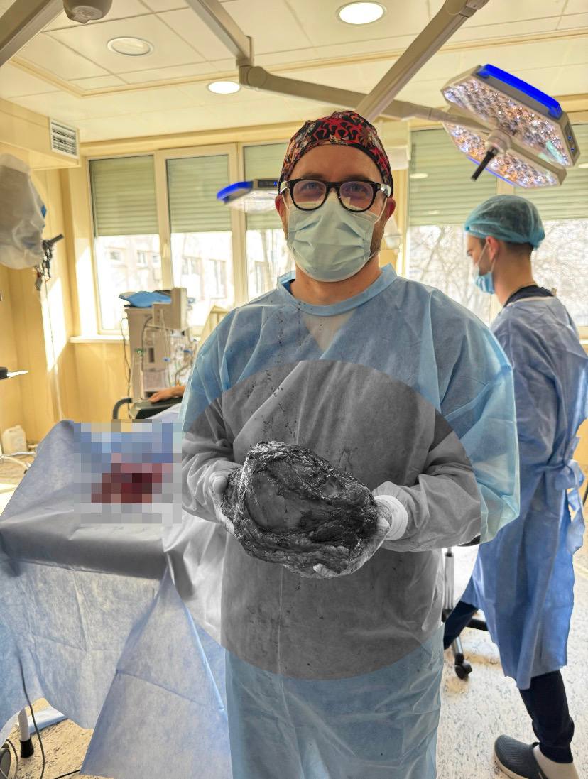 “Life Shouldn’t Be Put on Hold”: An Interview with Bohdan Maksymenko, Oncologist and Founder of the Ukrainian Sarcoma Foundation 5 “Life Shouldn’t Be Put on Hold”: An Interview with Bohdan Maksymenko, Oncologist and Founder of the Ukrainian Sarcoma Foundation